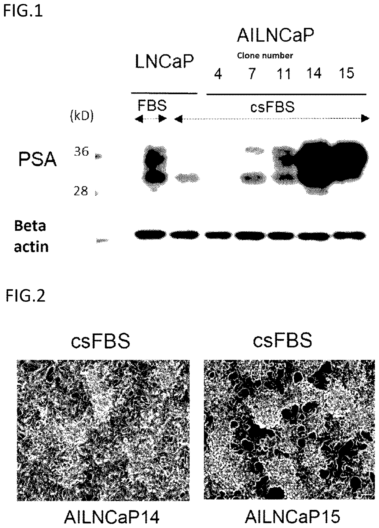 Cancer treatment pharmaceutical composition containing cdk inhibitor