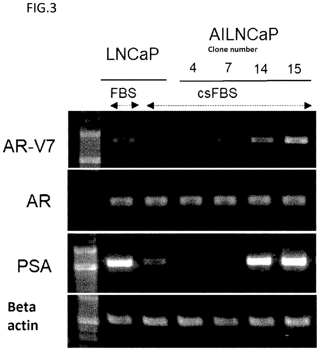 Cancer treatment pharmaceutical composition containing cdk inhibitor