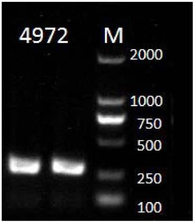 Primer, kit and method for detecting PIGA gene promoter region 4972A&gt;G mutation site