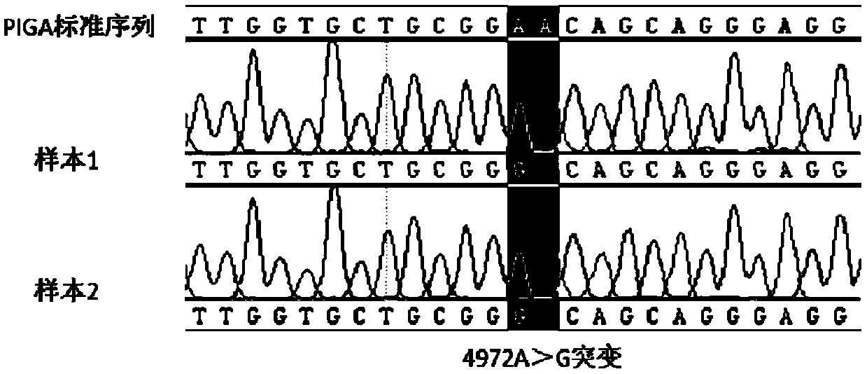 Primer, kit and method for detecting PIGA gene promoter region 4972A&gt;G mutation site