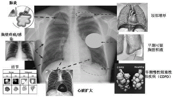 Health indicator index classification system and method based on chest radiography of healthy people