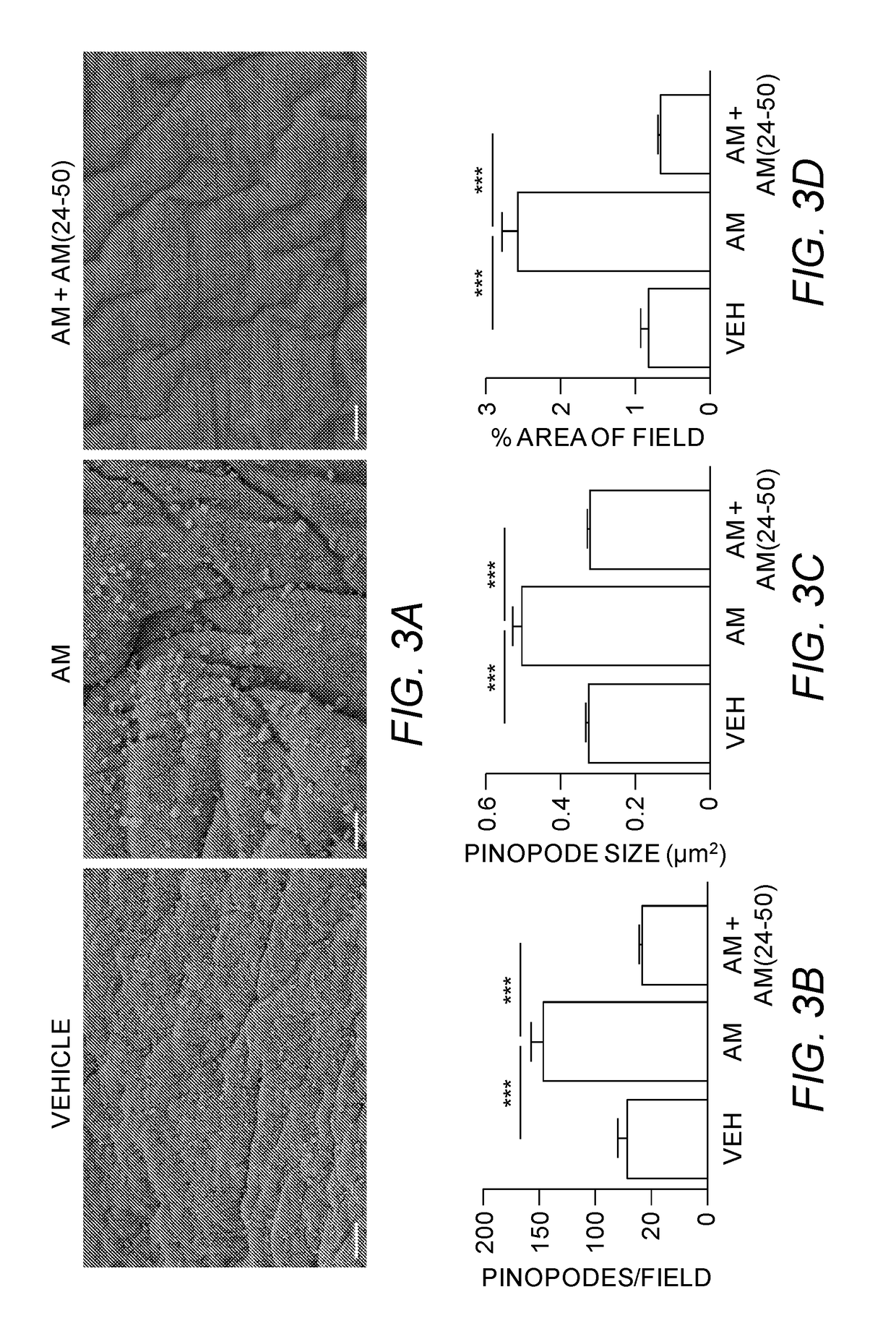 Adrenomedullin therapy to improve fetal implantation