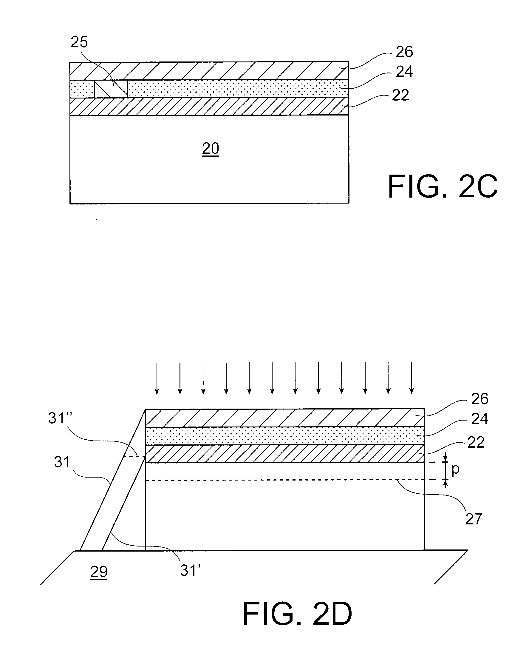 Method for implanting a piezoelectric material