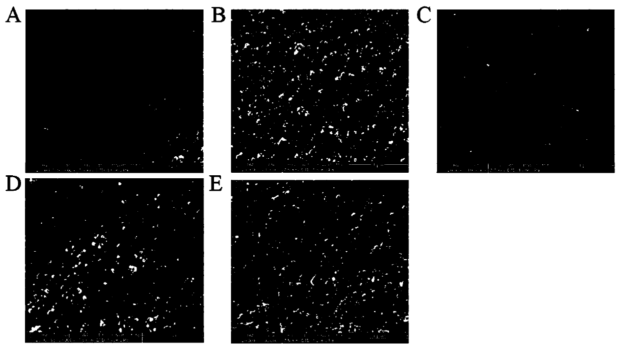 Method for detecting alpha-fetal protein on basis of RGO-CS-Fc/Au NPs nano composite material and aptamers