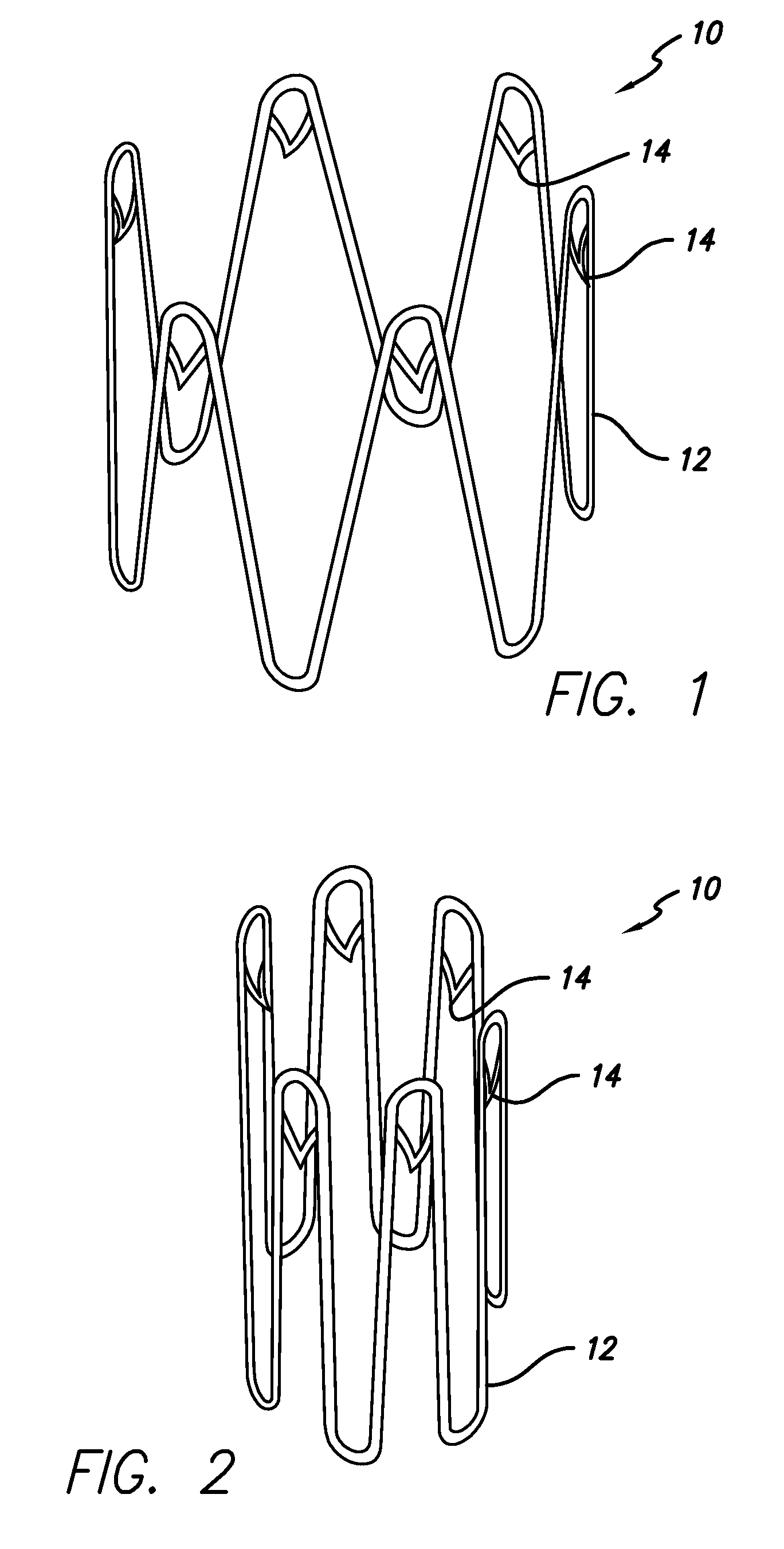 Anchoring device for an endoluminal prosthesis