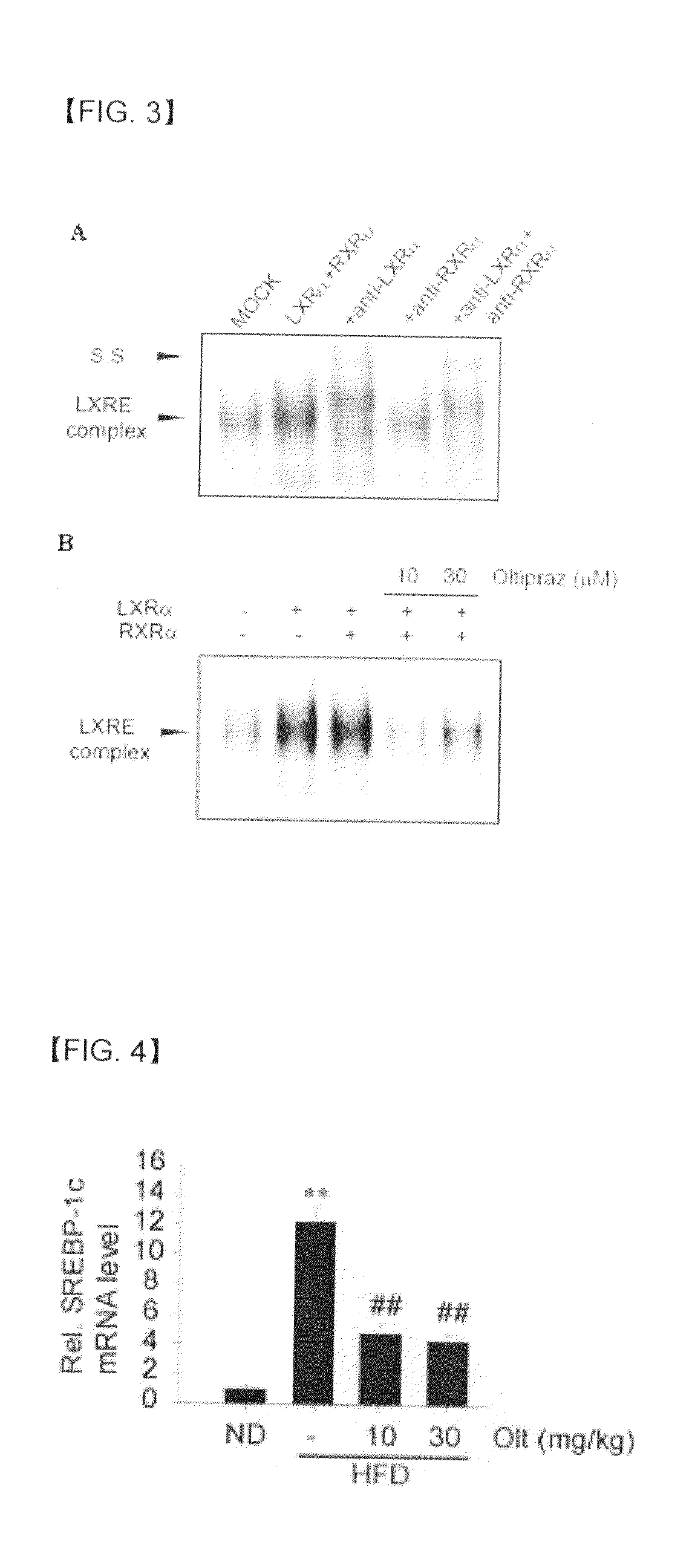 Pharmaceutical composition containing 1,2-dithiolthione derivative for preventing or treating disease caused by overexpression of lxr-alpha