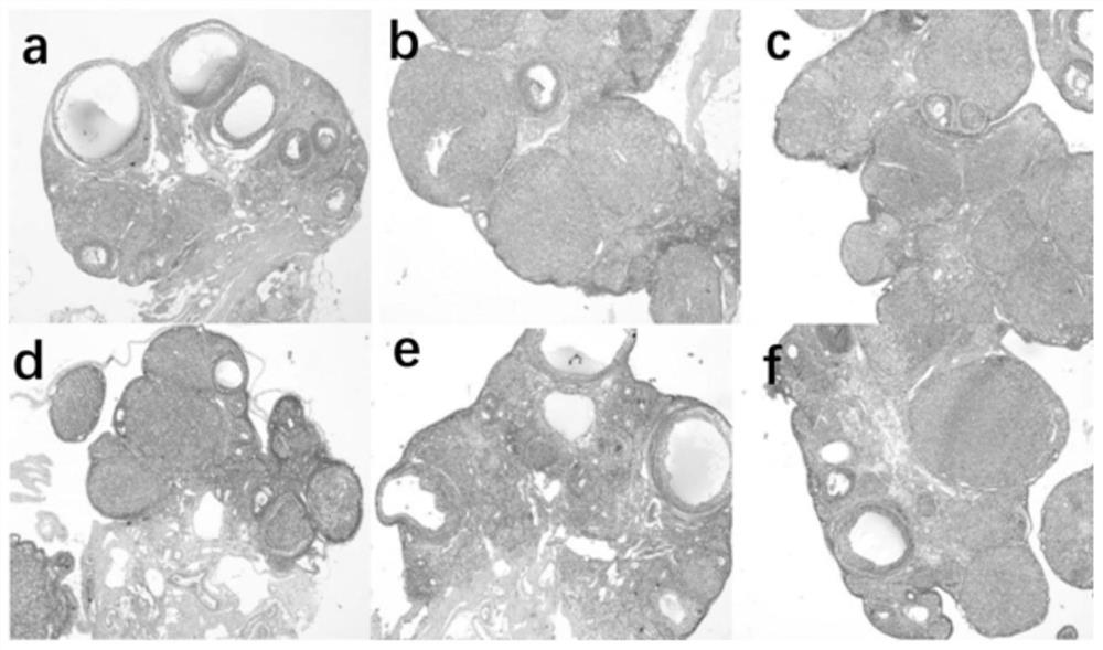 Medicine for nourishing yin and soothing liver, its preparation method and application