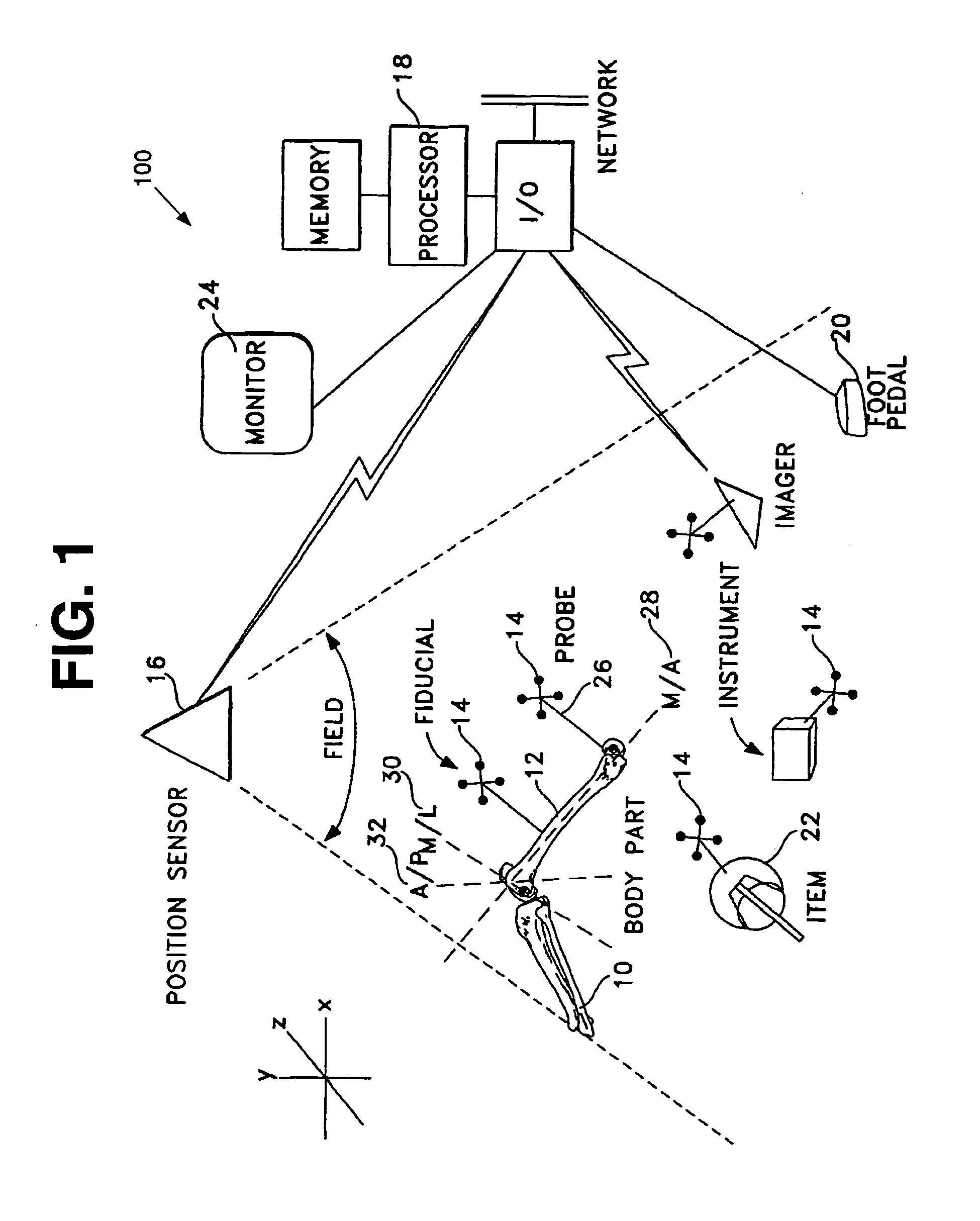 System and method for modular navigated osteotome