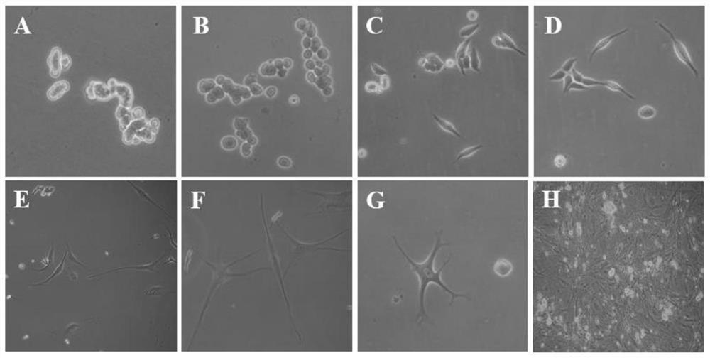 A culture system and method for efficient differentiation of spermatogonial stem cells into neural cells