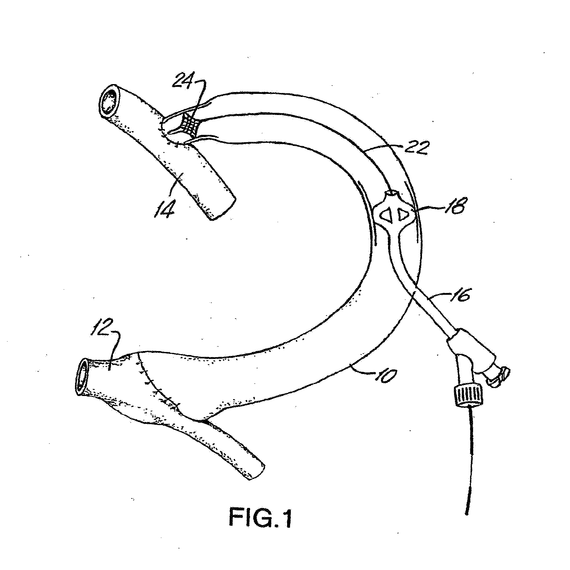 Temporary Vascular Scaffold and Scoring Device