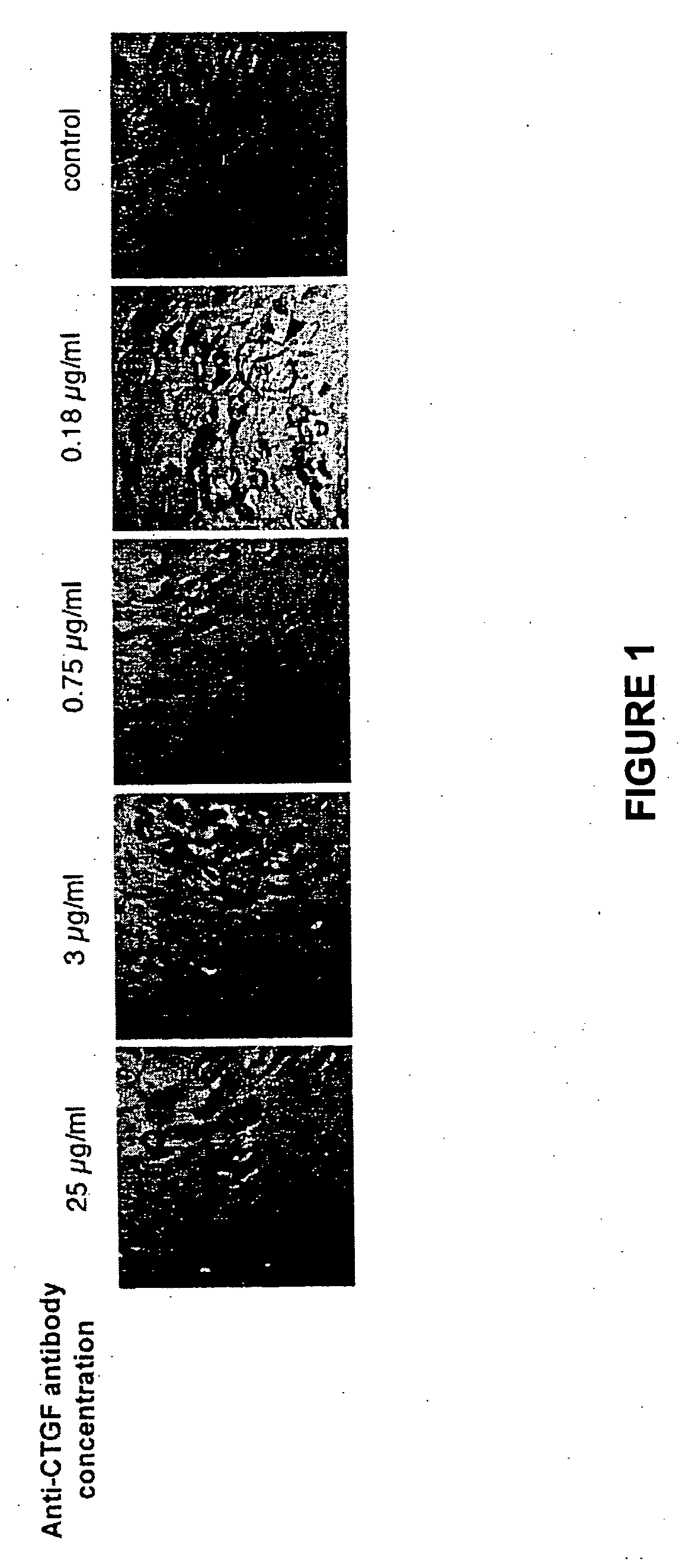 Methods and compositions for the treatment of polycystic diseases