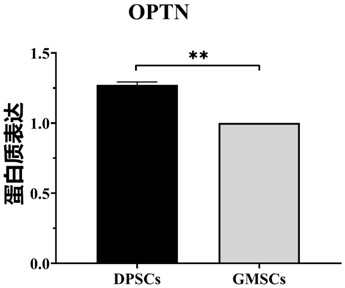 Application of OPTN gene in identification of dental pulp stem cells for identifying dental pulp stem cells and method thereof and product