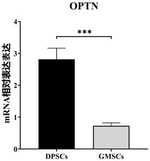 Application of OPTN gene in identification of dental pulp stem cells for identifying dental pulp stem cells and method thereof and product