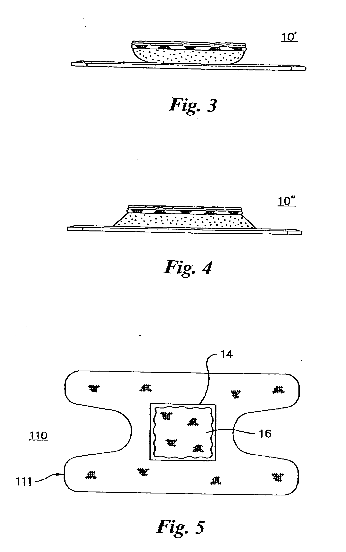 Devices and methods of treatment of wounds and burns and related impaired blood circulation problems