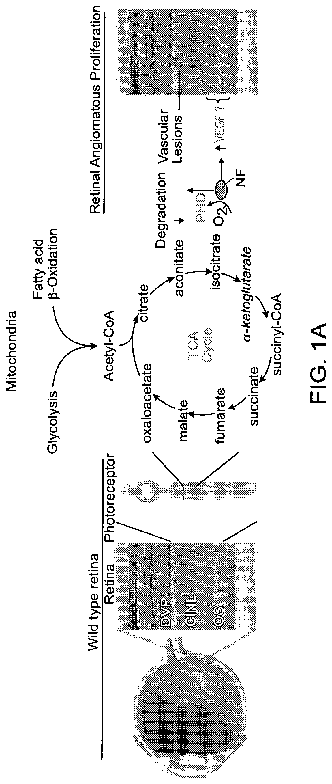 Ffa1 (GPR40) as a therapeutic target for neural angiogenesis diseases or disorders