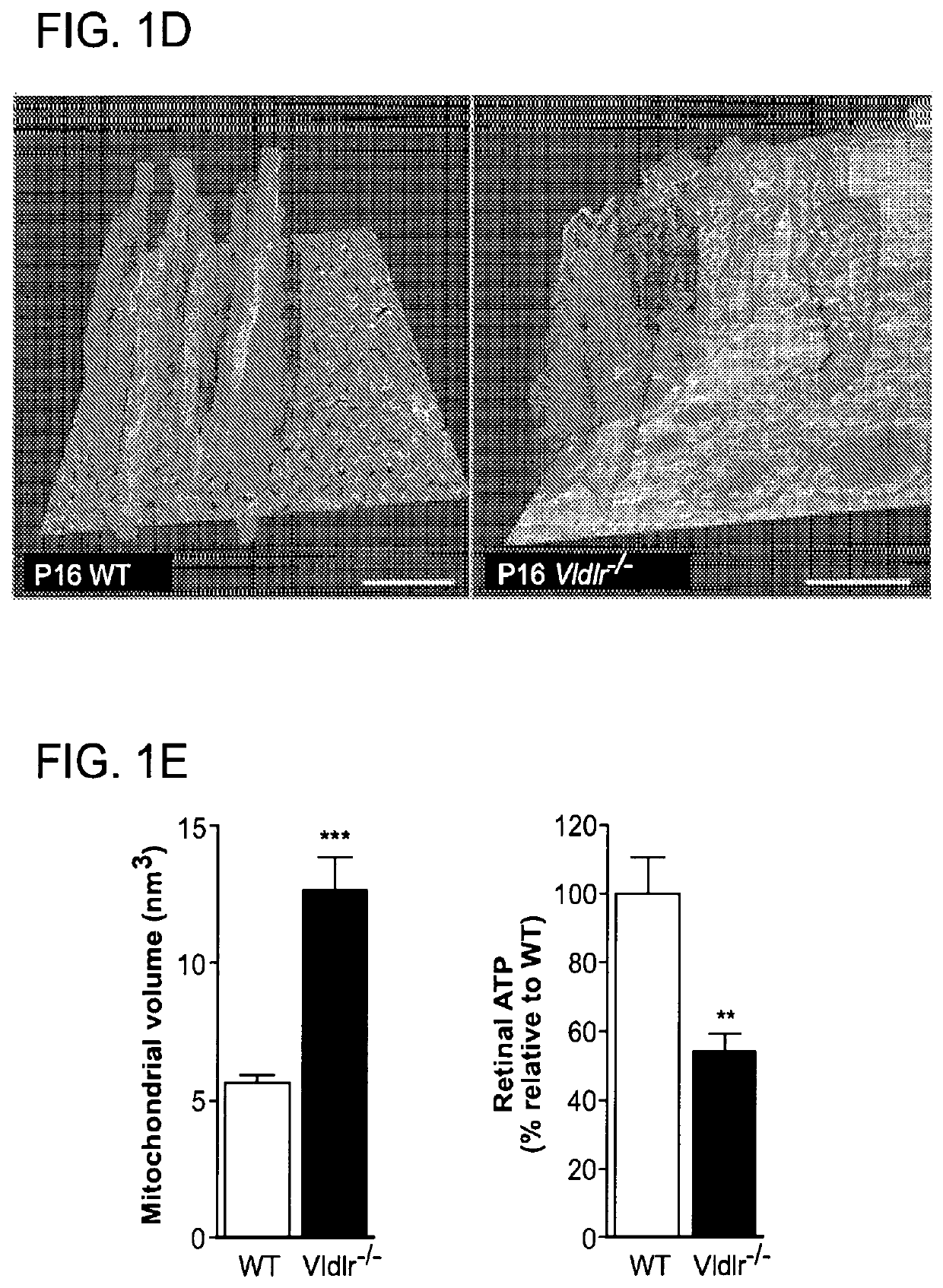 Ffa1 (GPR40) as a therapeutic target for neural angiogenesis diseases or disorders