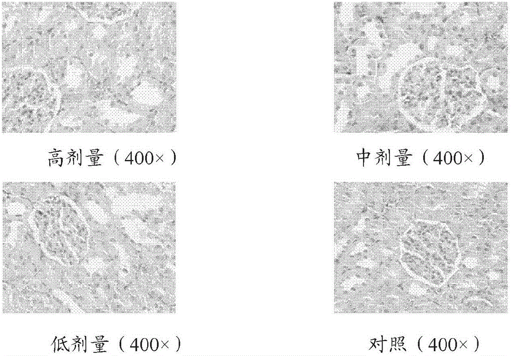 A kind of rhubarb anthraquinone oral colon targeted drug delivery composition and use thereof