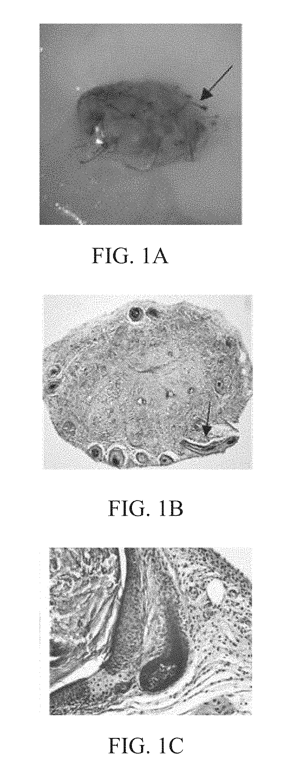 Method and composition of inducing hair follicle neogenesis