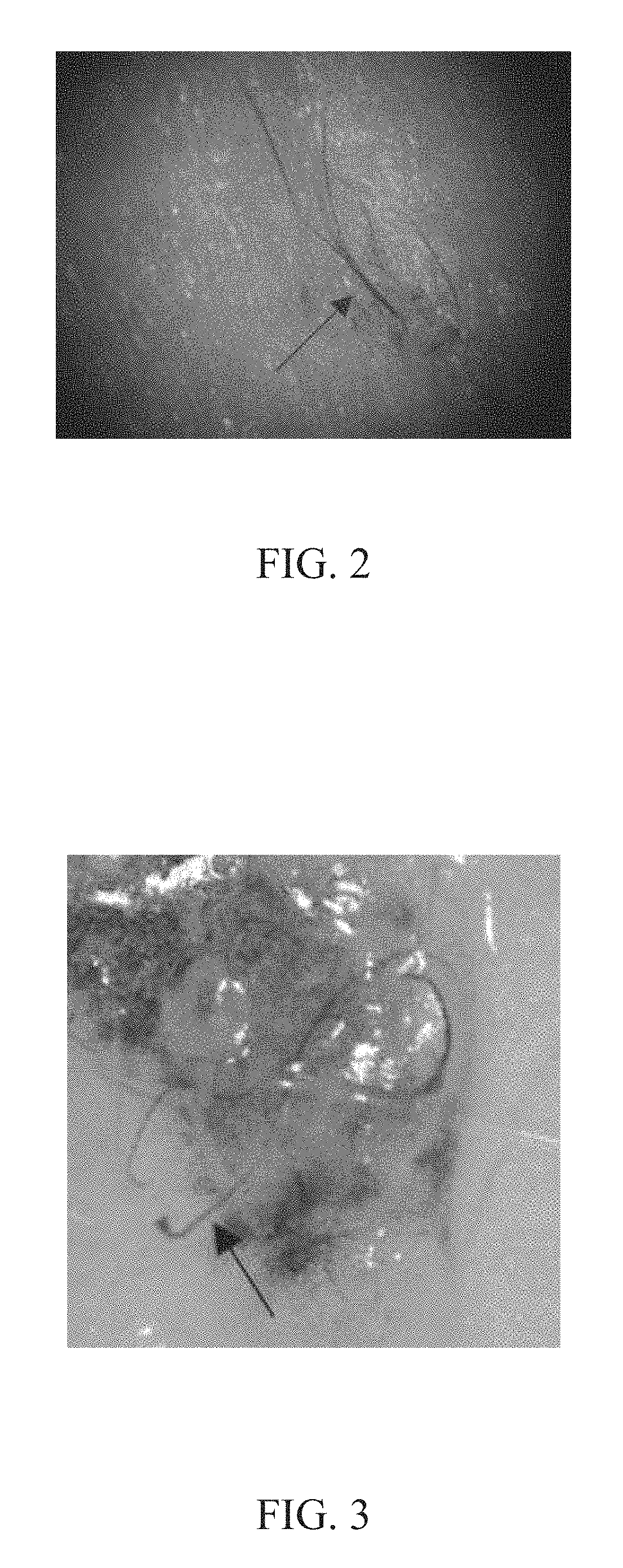Method and composition of inducing hair follicle neogenesis