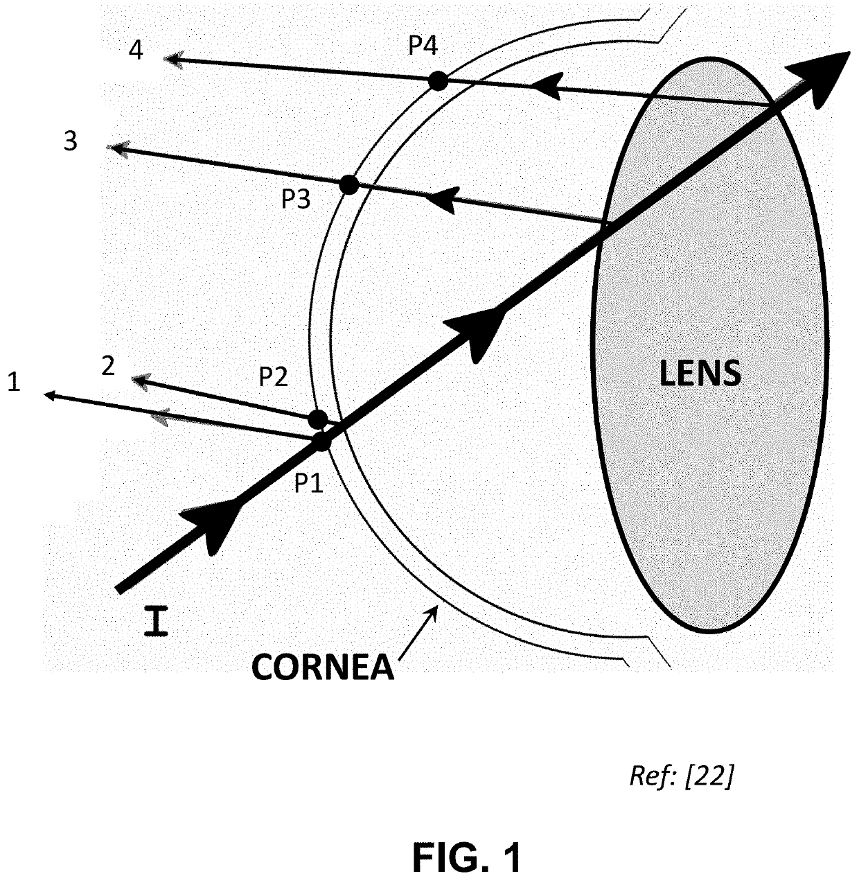 System and Methods for Dynamic Position Measurement of Ocular Structures
