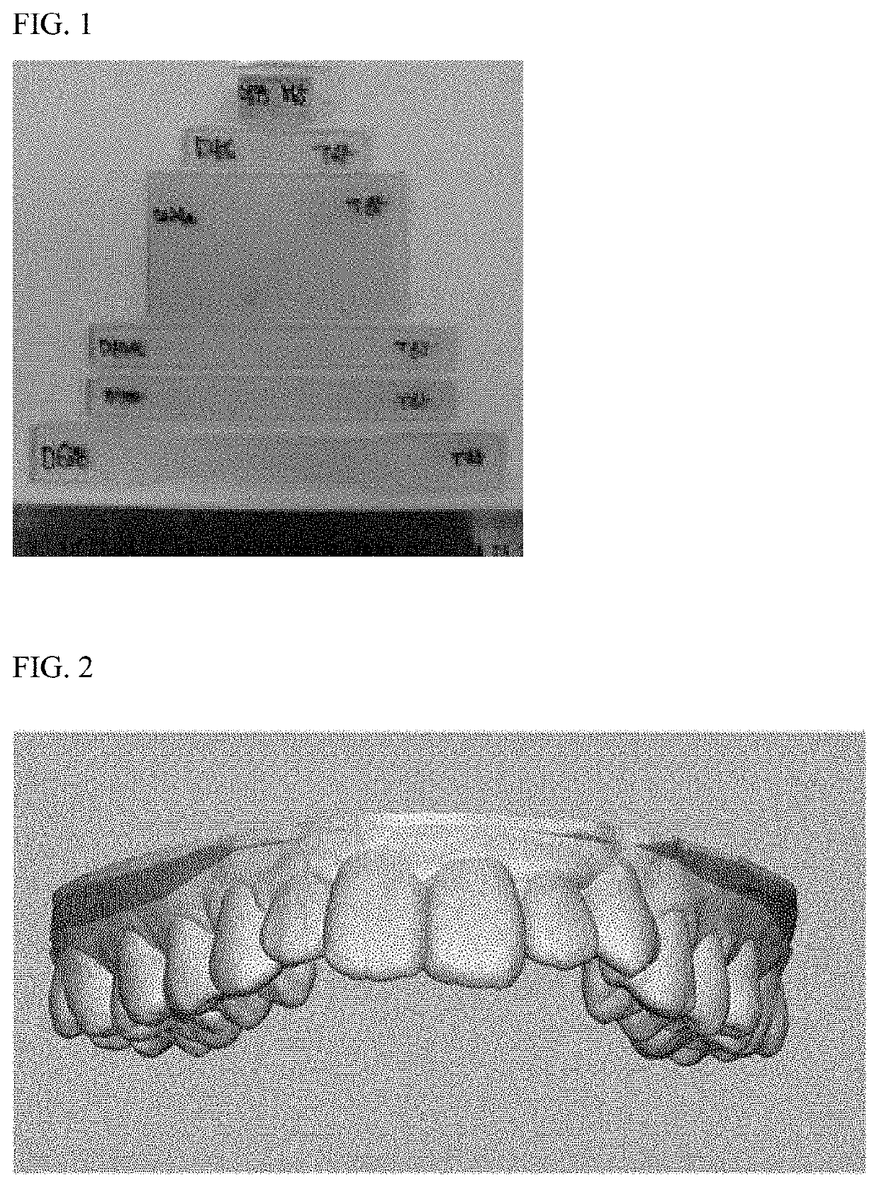 Photocurable composition for 3D printer for producing transparent orthodontic device