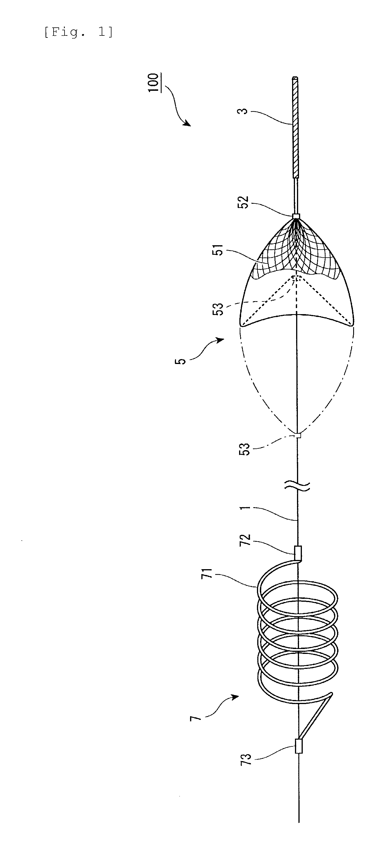 Embolic material excision trapping device