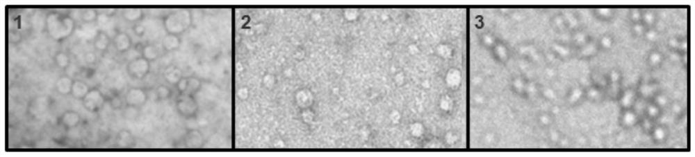 A preparation method and application method of human mesenchymal stem cell exosome freeze-dried powder