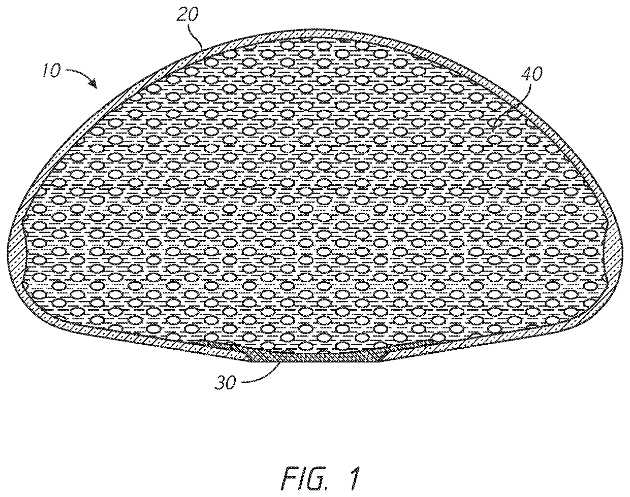 Implantable prostheses for tissue expansion