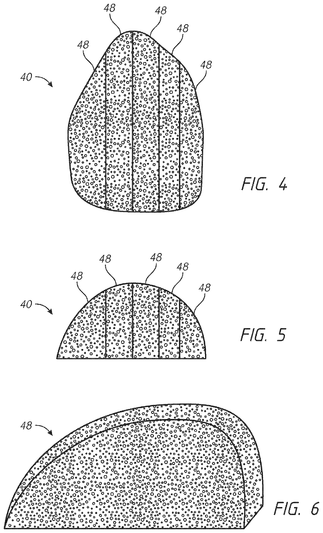 Implantable prostheses for tissue expansion