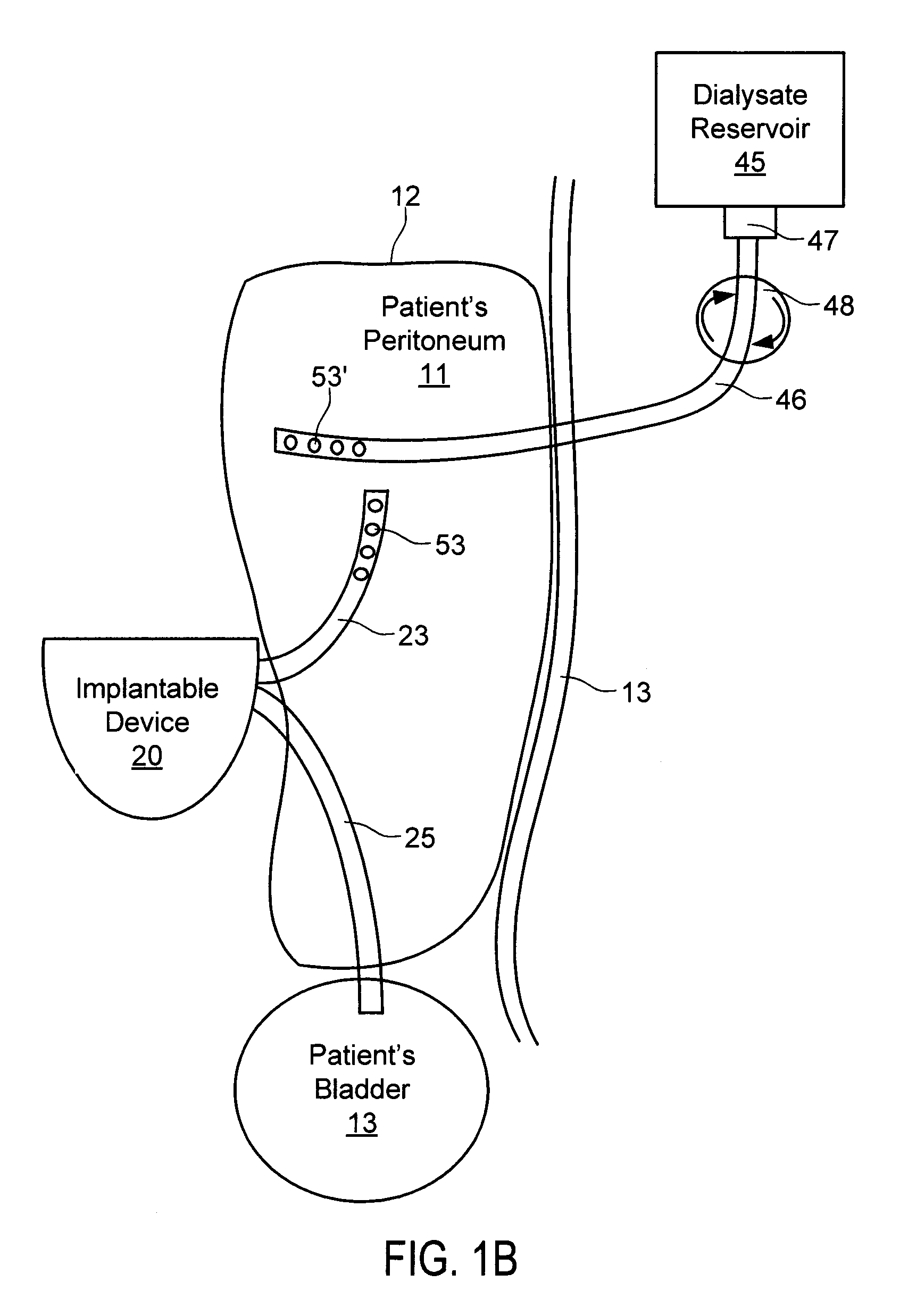 Systems and methods for treating chronic liver failure based on peritoneal dialysis