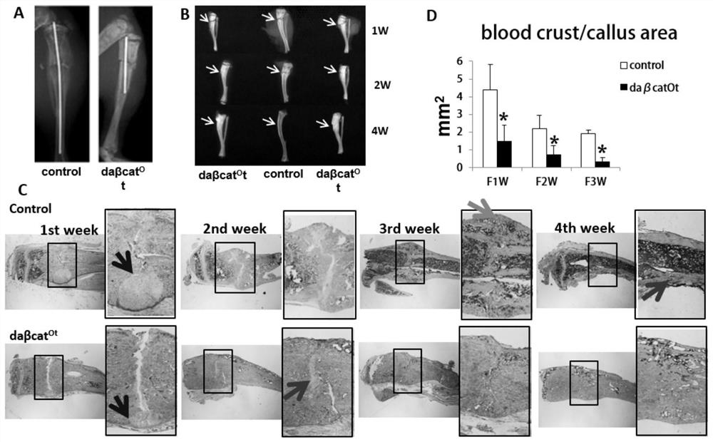 Application of bone cell Wnt activator in preparation of medicine for accelerating fracture healing and preventing and treating bone nonunion and non-movement or weightless bone loss