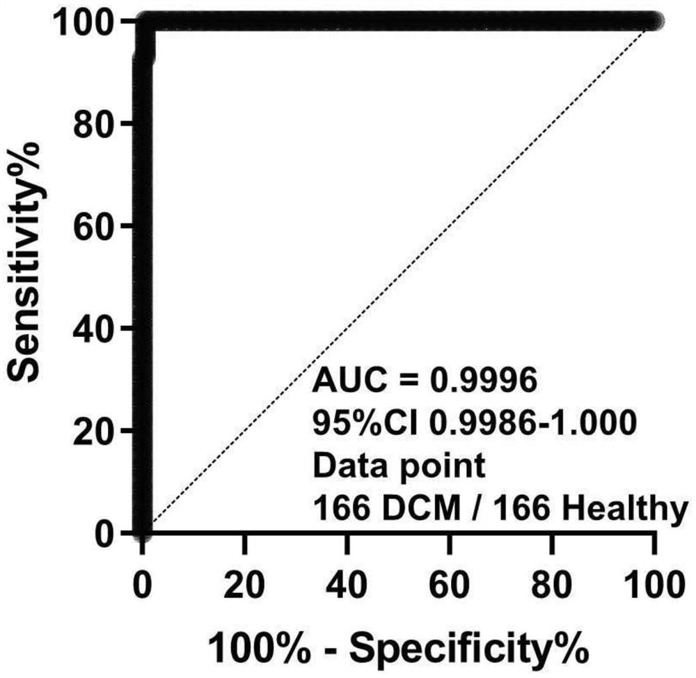 Diagnostic marker, scoring model and diagnostic product for dilated cardiomyopathy