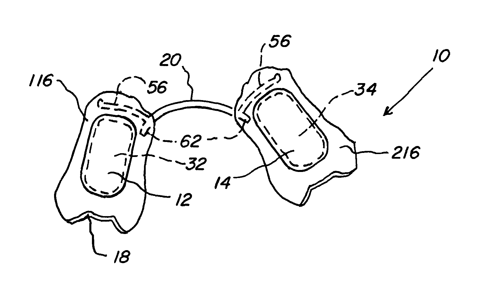 Oral appliances with major connectors and methods for manufacture