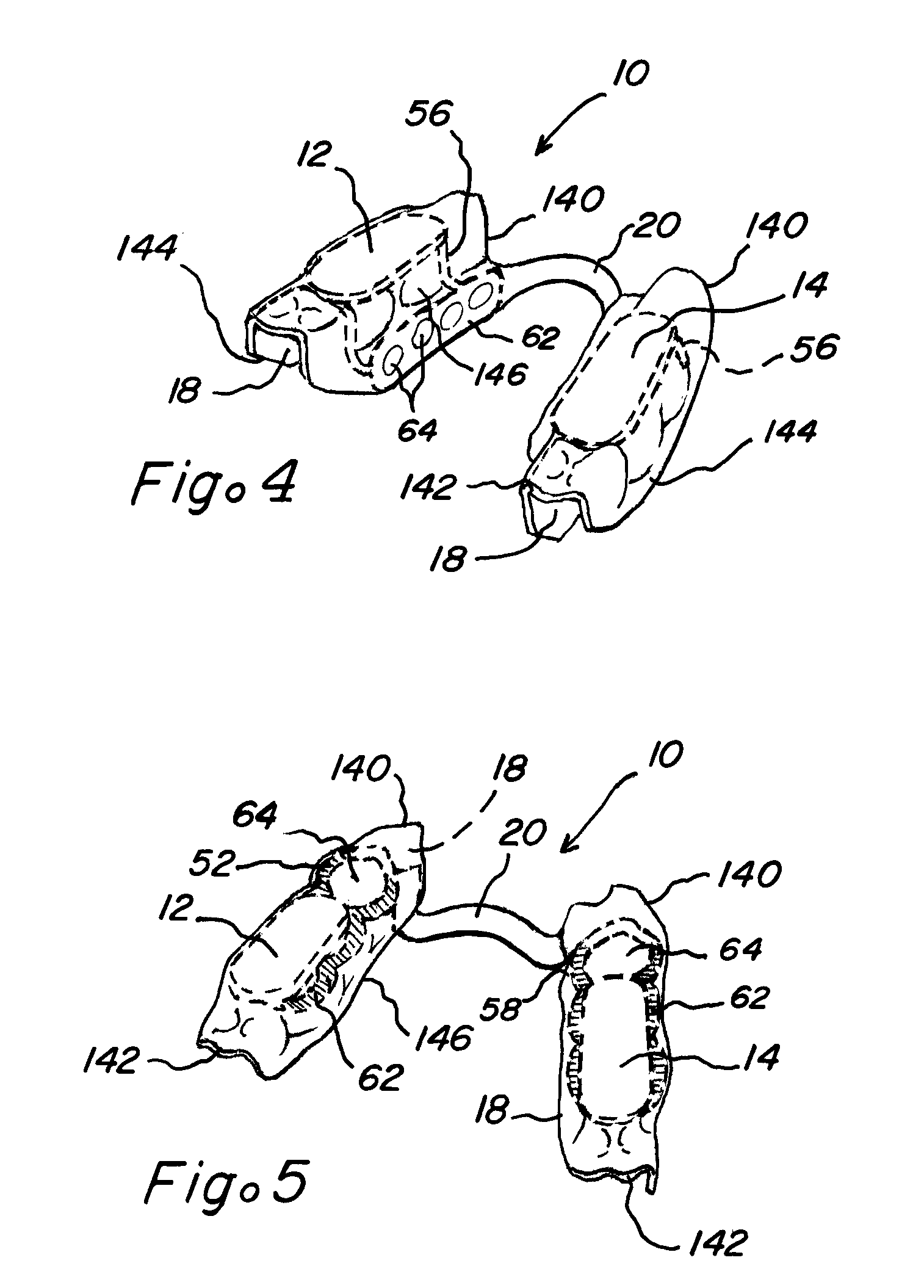 Oral appliances with major connectors and methods for manufacture