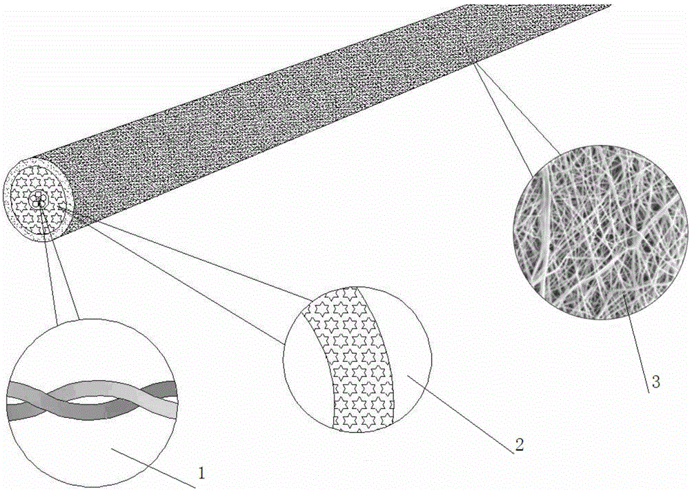 Anal fistula thread of three-dimensional composite structure and preparation method of anal fistula thread