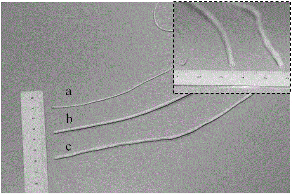 Anal fistula thread of three-dimensional composite structure and preparation method of anal fistula thread