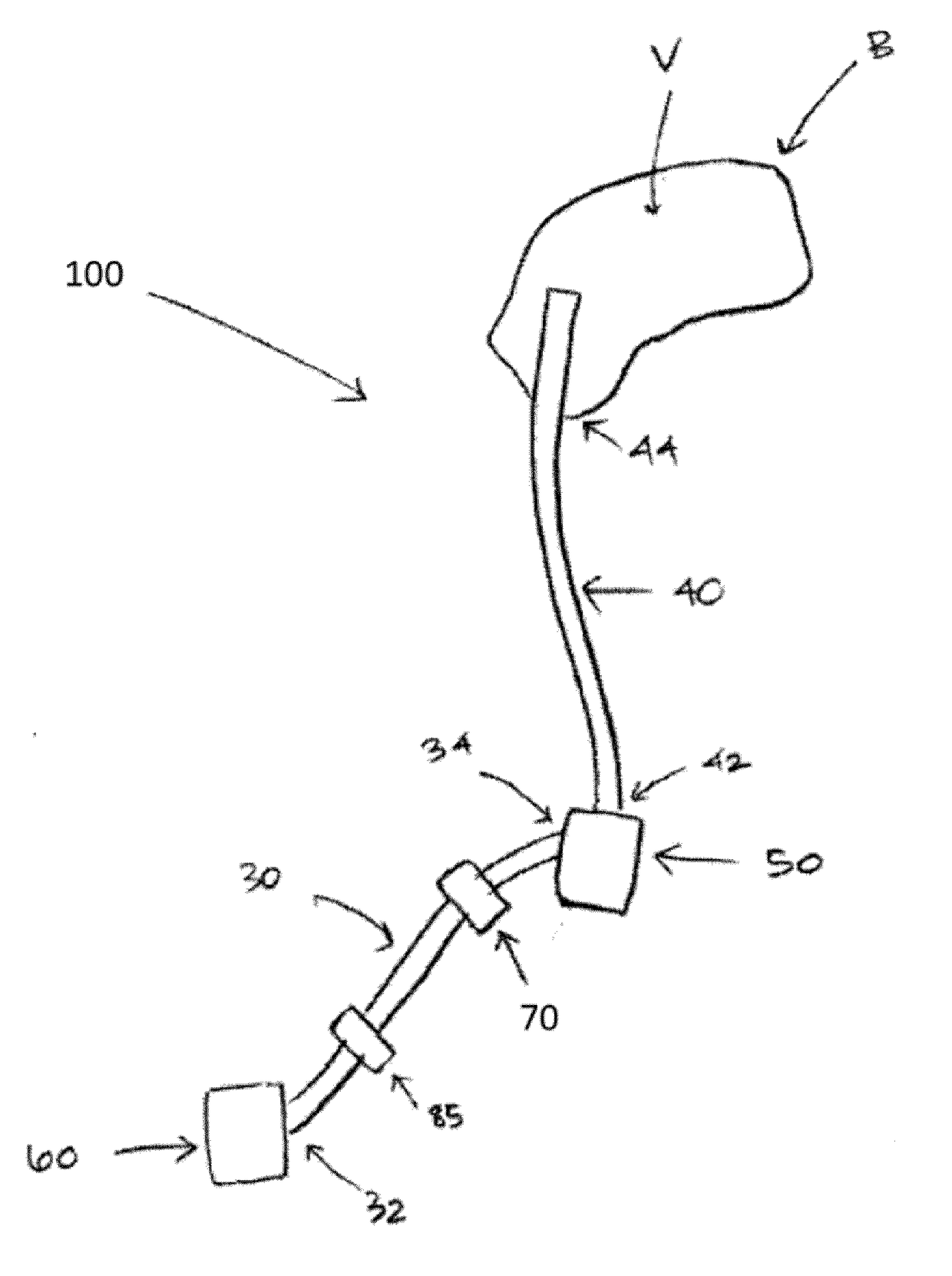 Therapeutic applications of artificial cerebrospinal fluid and tools provided therefor