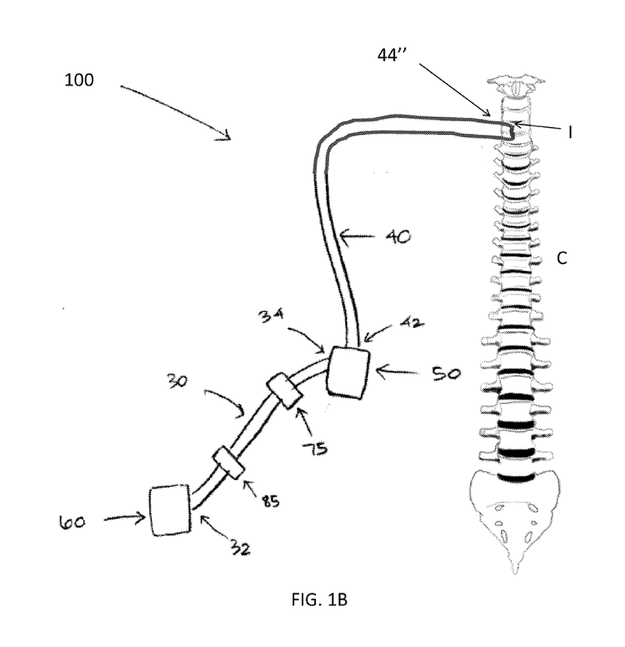 Therapeutic applications of artificial cerebrospinal fluid and tools provided therefor