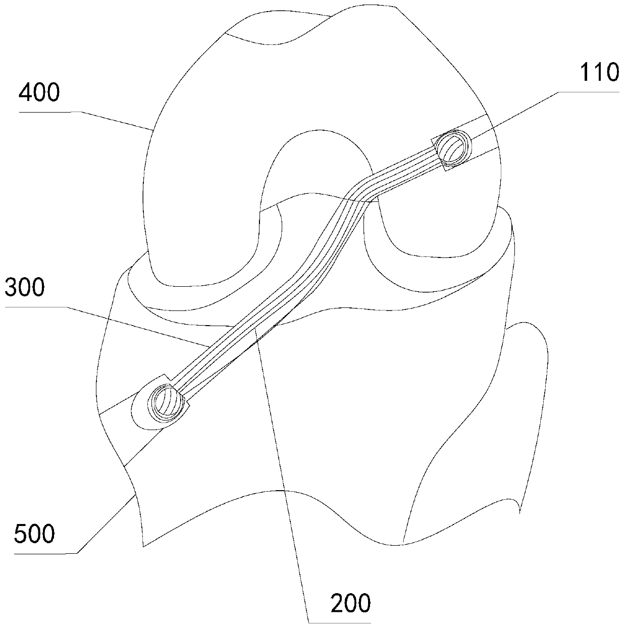 Ligament reconstruction fixing device and using method thereof