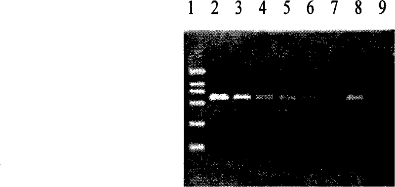 Process for abstracting bacterial DNA from phlegm, kit and uses thereof