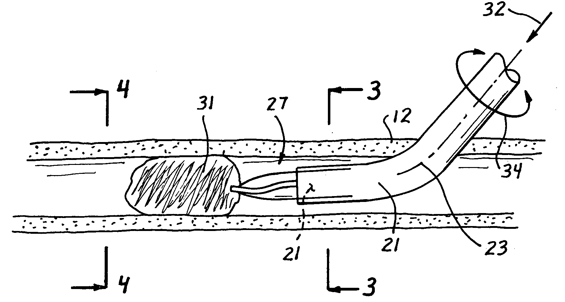 Catheter with conduit traversing tip