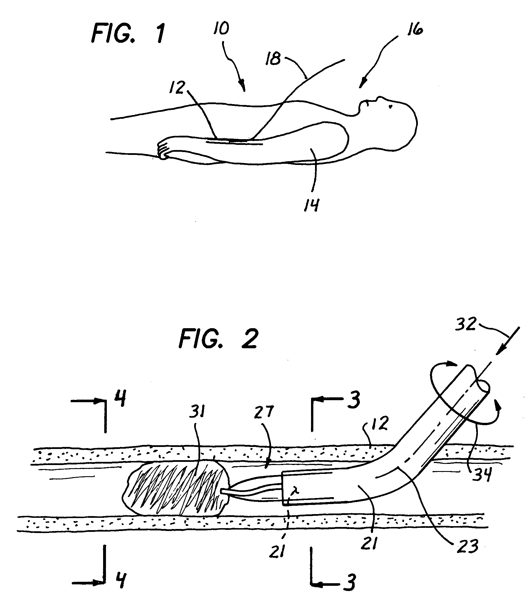 Catheter with conduit traversing tip