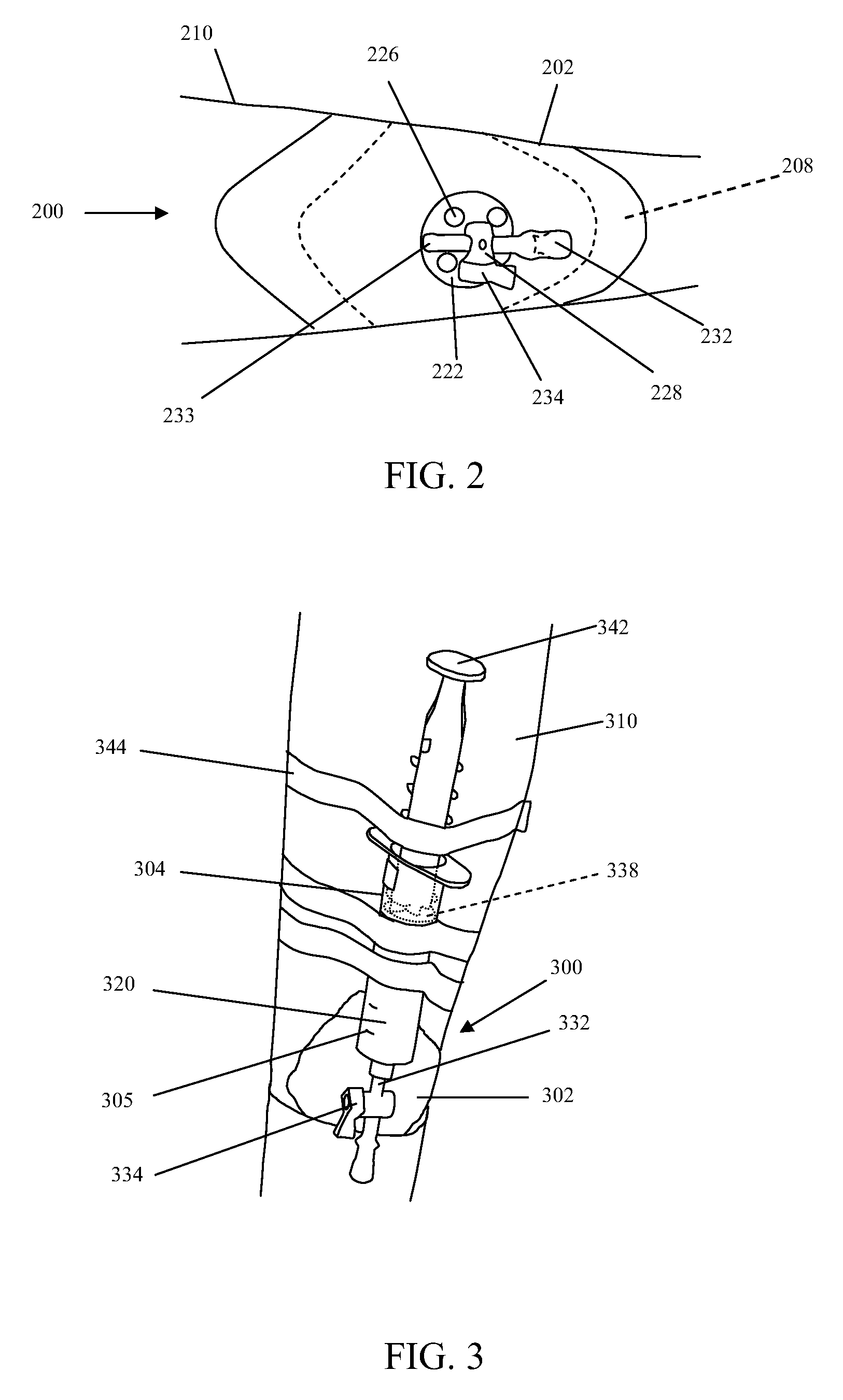 Methods for application of reduced pressure therapy