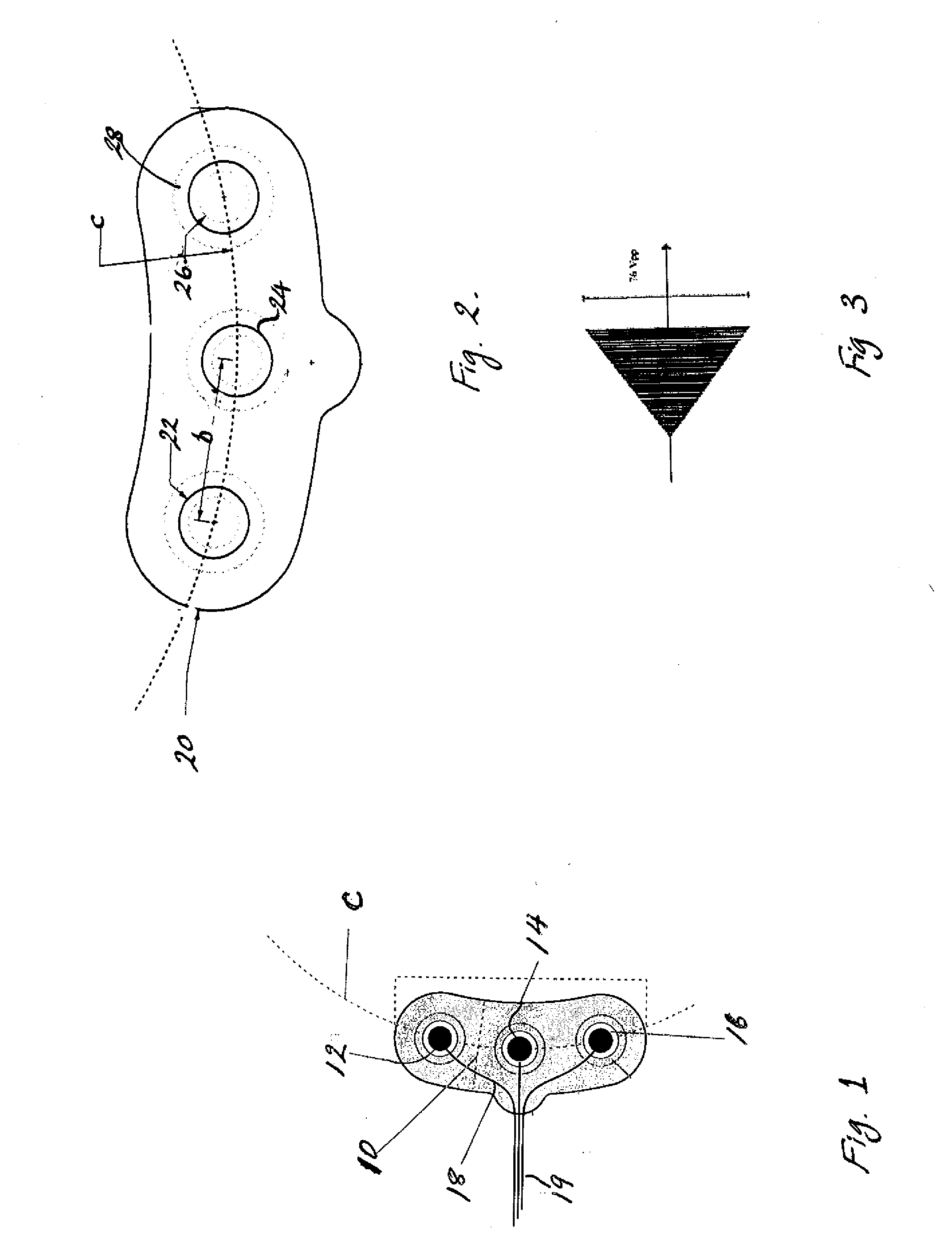 Electrode assemblies and bruxism monitoring apparatus