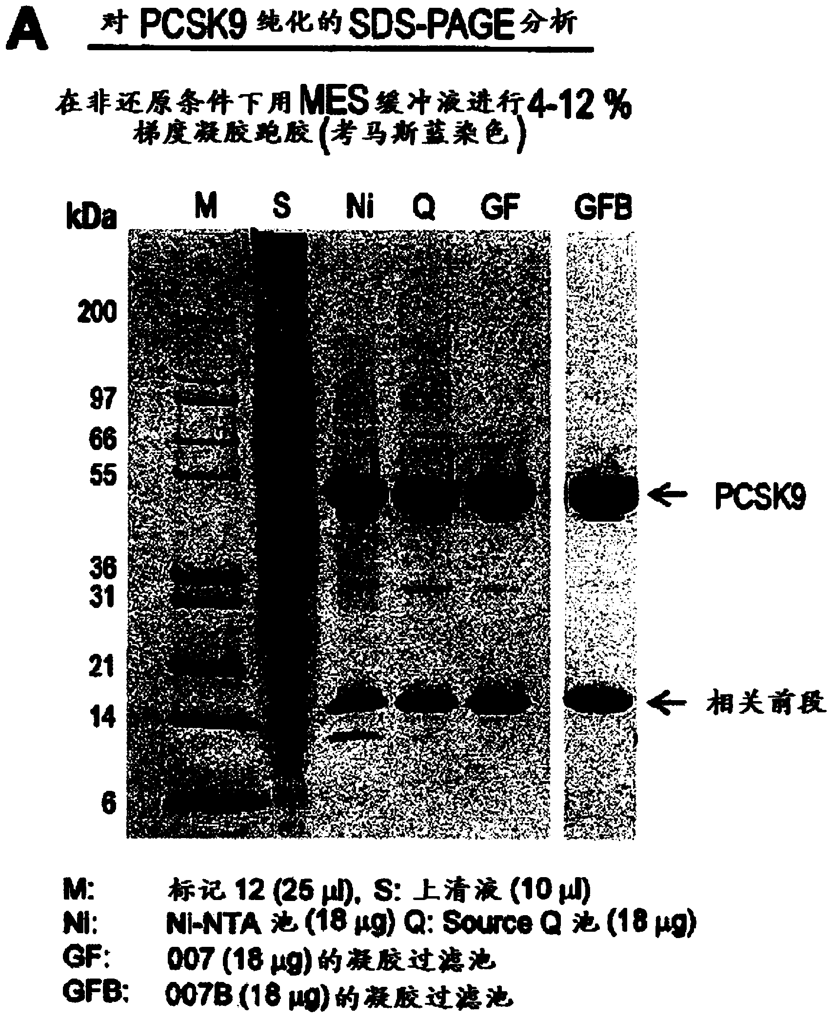 Single domain antibodies as inhibitors of PCSK9