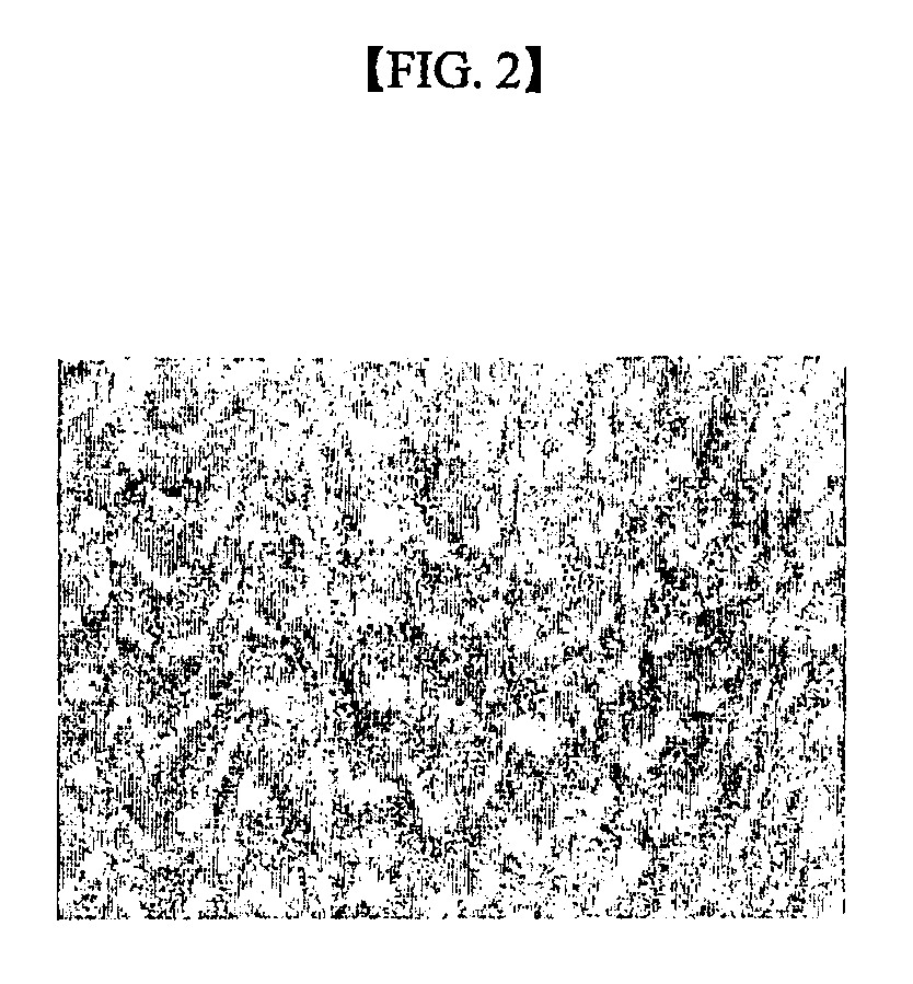Method for differentiating mesenchymal stem cell into neural cell and pharmaceutical composition containing the neural cell for neurodegenerative disease