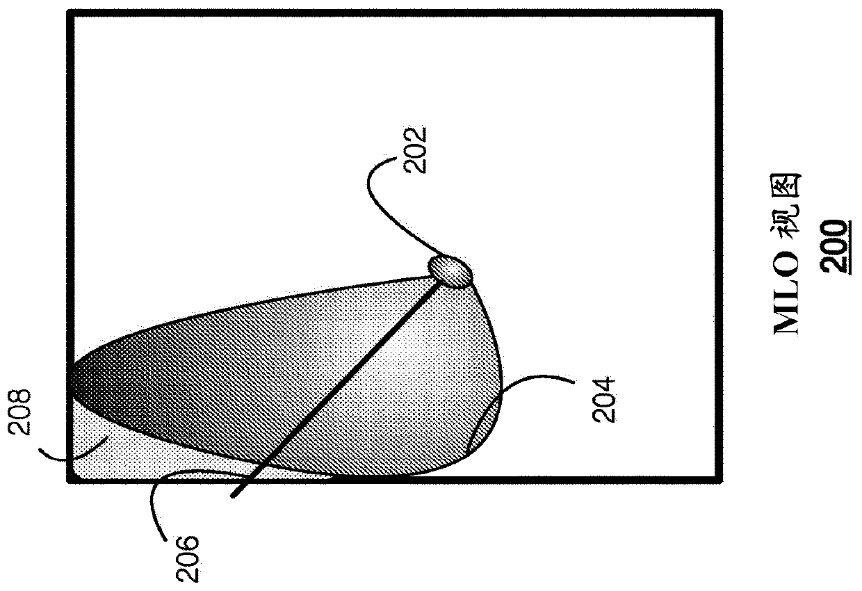 Techniques for Quality Assurance of Patient Positioning Prior to Mammography Image Acquisition