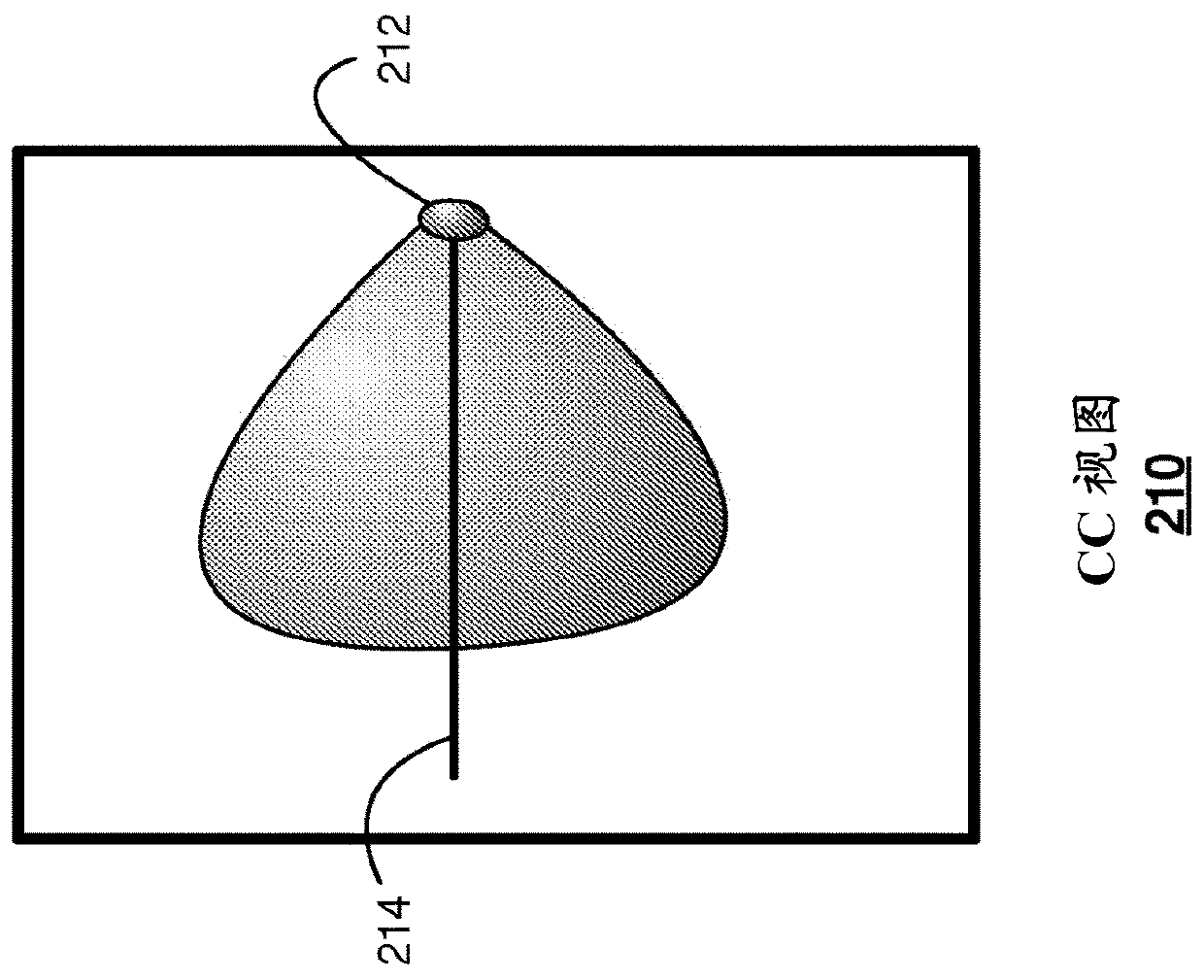 Techniques for Quality Assurance of Patient Positioning Prior to Mammography Image Acquisition