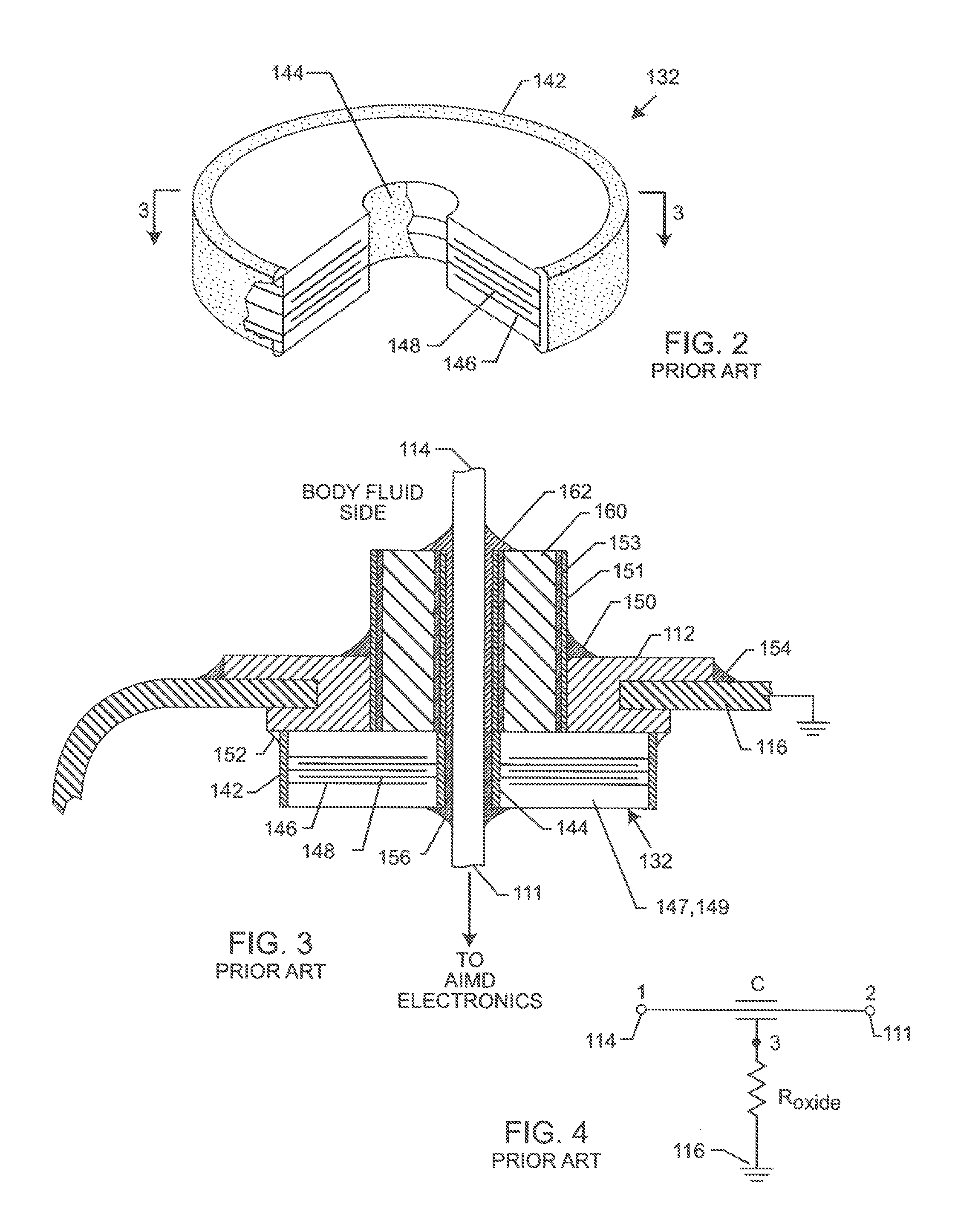 Low impedance oxide resistant grounded capacitor for an AIMD