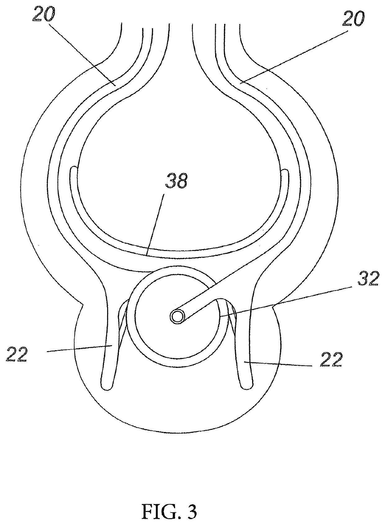 Nasal air flow maintenance and septal deviation correction device